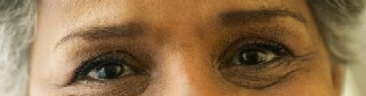 eyeimage